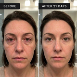 Regenex Steam Therapy Pro comfort moment